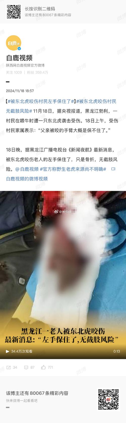 动物园老虎伤人事件（动物园老虎伤人,谁担责?）
